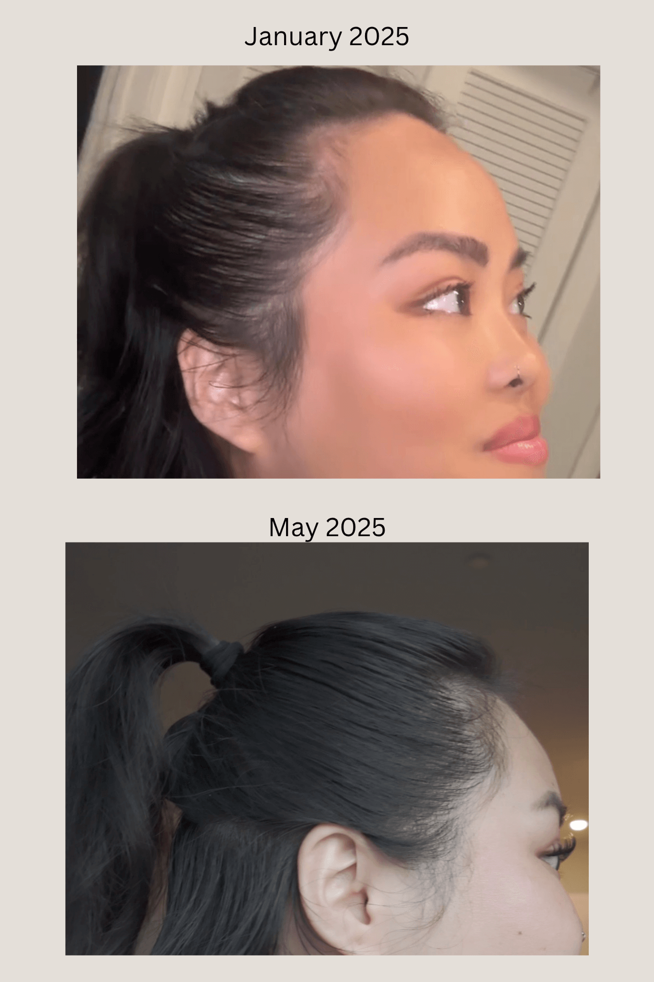 Side-by-side comparison of Olivia's hair in January and May 2025.